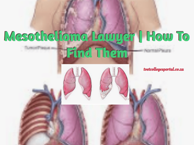 Mesothelioma What To Know About It